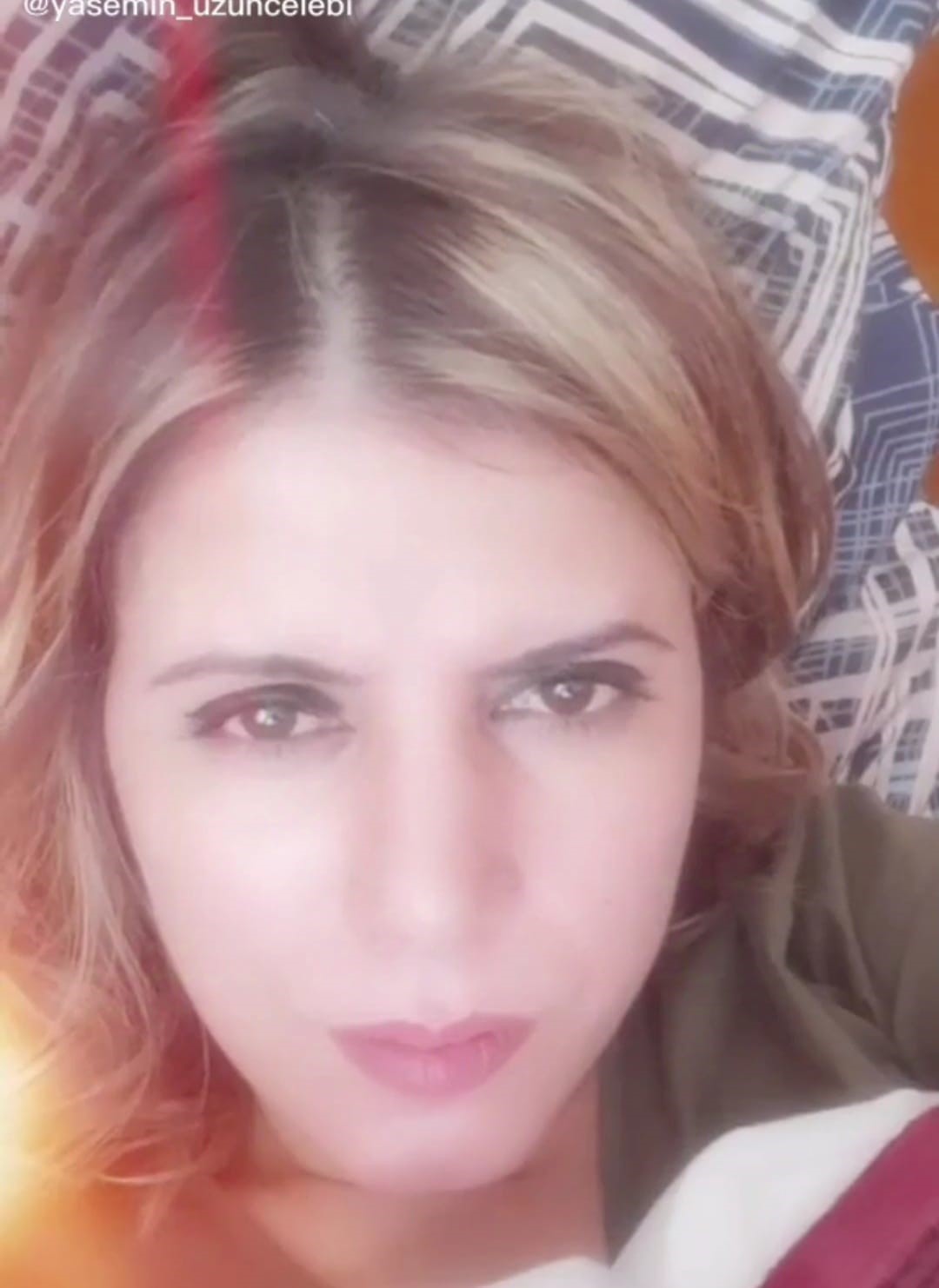 Kezzapla Yüzü Yakıldı ‘Kadınlar Tatlı Sözlere Kanmasın