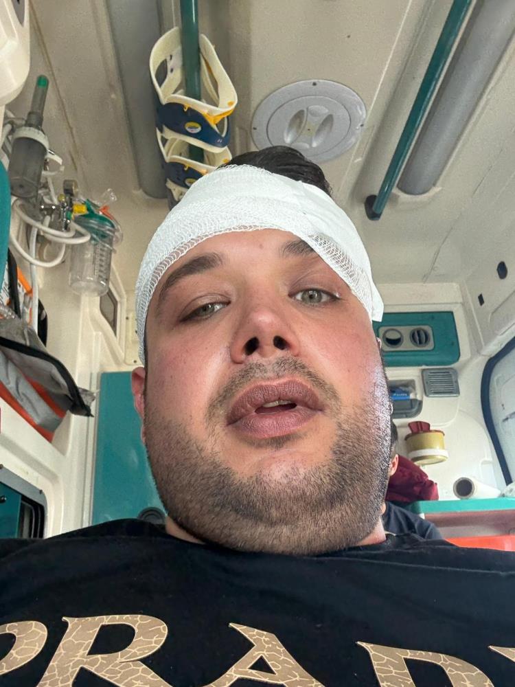 İyi̇ Partili Yönetici Gazeteci Enes Tozlu’yu Darp Etti (2)