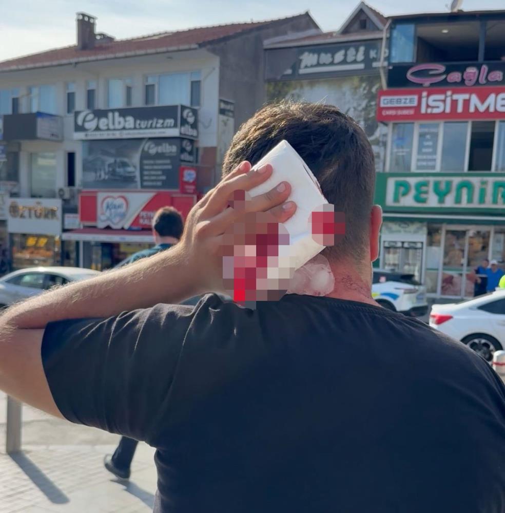 İyi̇ Partili Yönetici Gazeteci Enes Tozlu’yu Darp Etti (3)