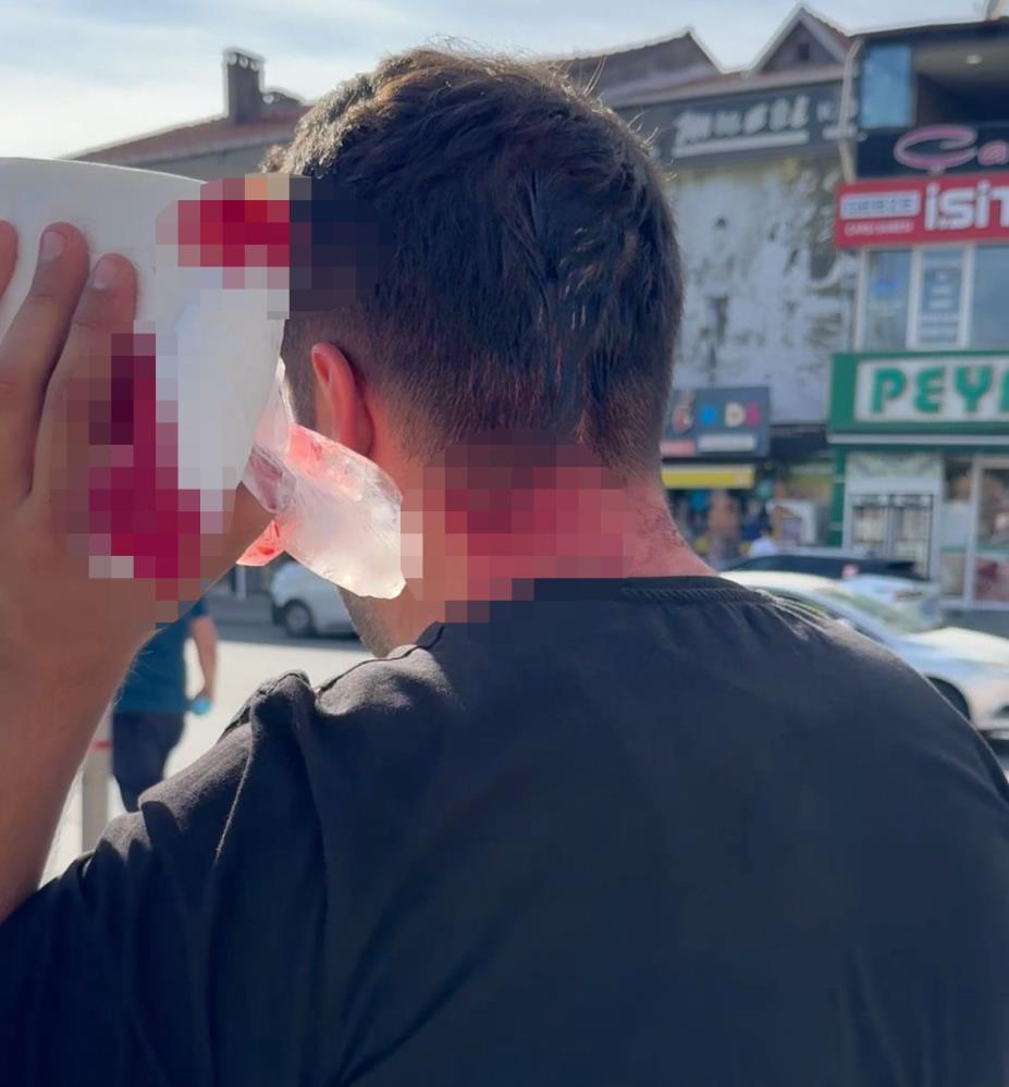İyi̇ Partili Yönetici Gazeteci Enes Tozlu’yu Darp Etti (4)
