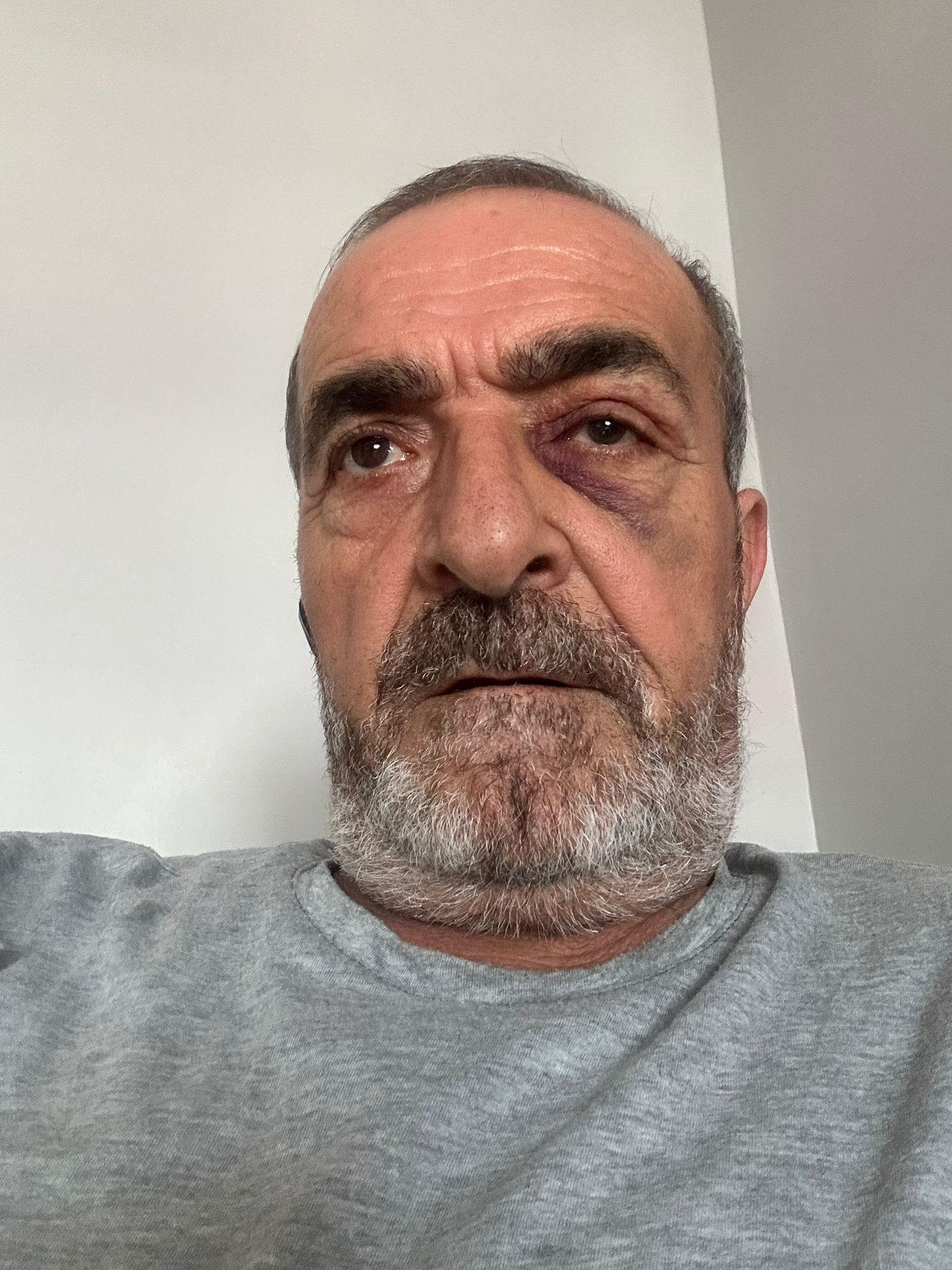 Cahit Özay Saldırıya Uğradı 3