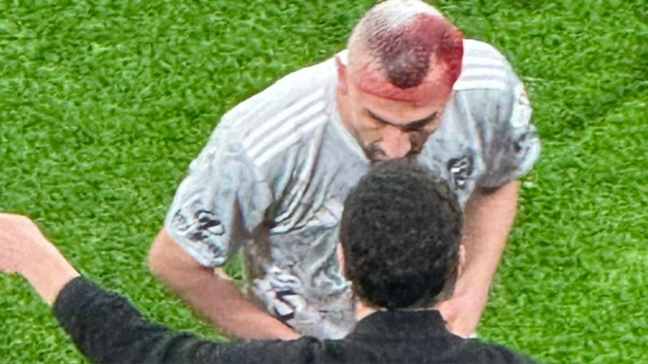 Serdar Dursun’un Başındaki Bandaj Açıldı, Kanama Yeniden Başladı. Oyuncu Şu Anda Kenarda Tedavi Görüyor Ve Kafasına Yeni Bandaj Yapılıyor.