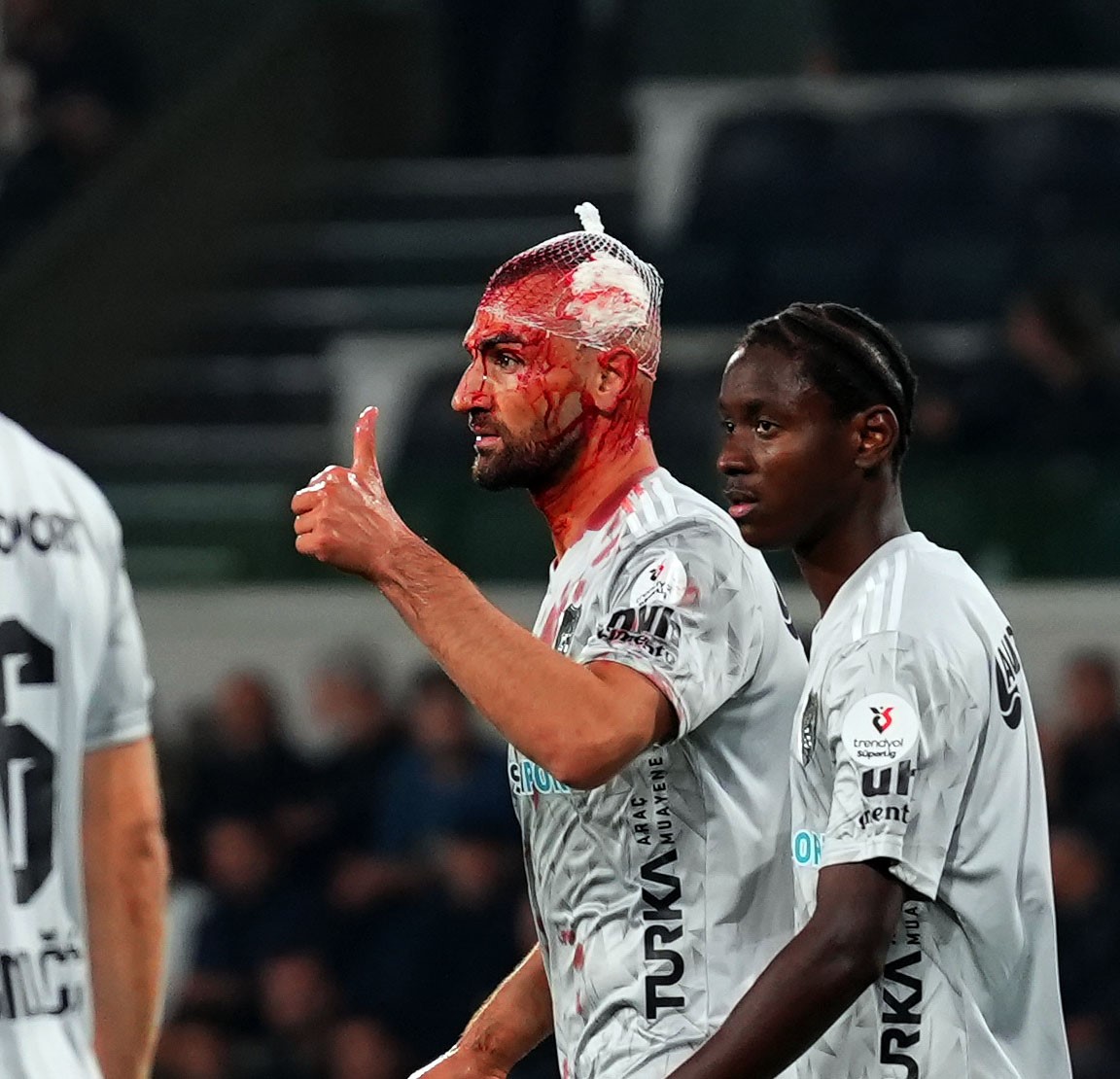 Serdar Dursun’un Kafası Yarıldı (6)