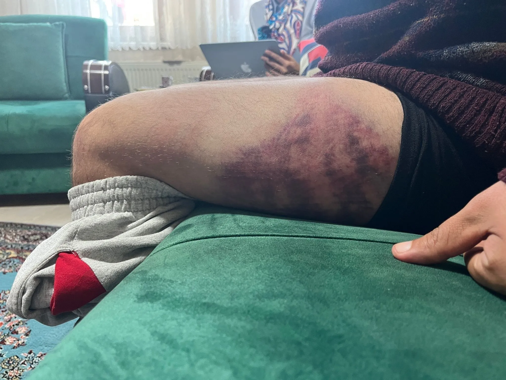 Otizmli Gence Odunla Şiddet Uygulamıştı! Fırıncı Tutuklandı-1