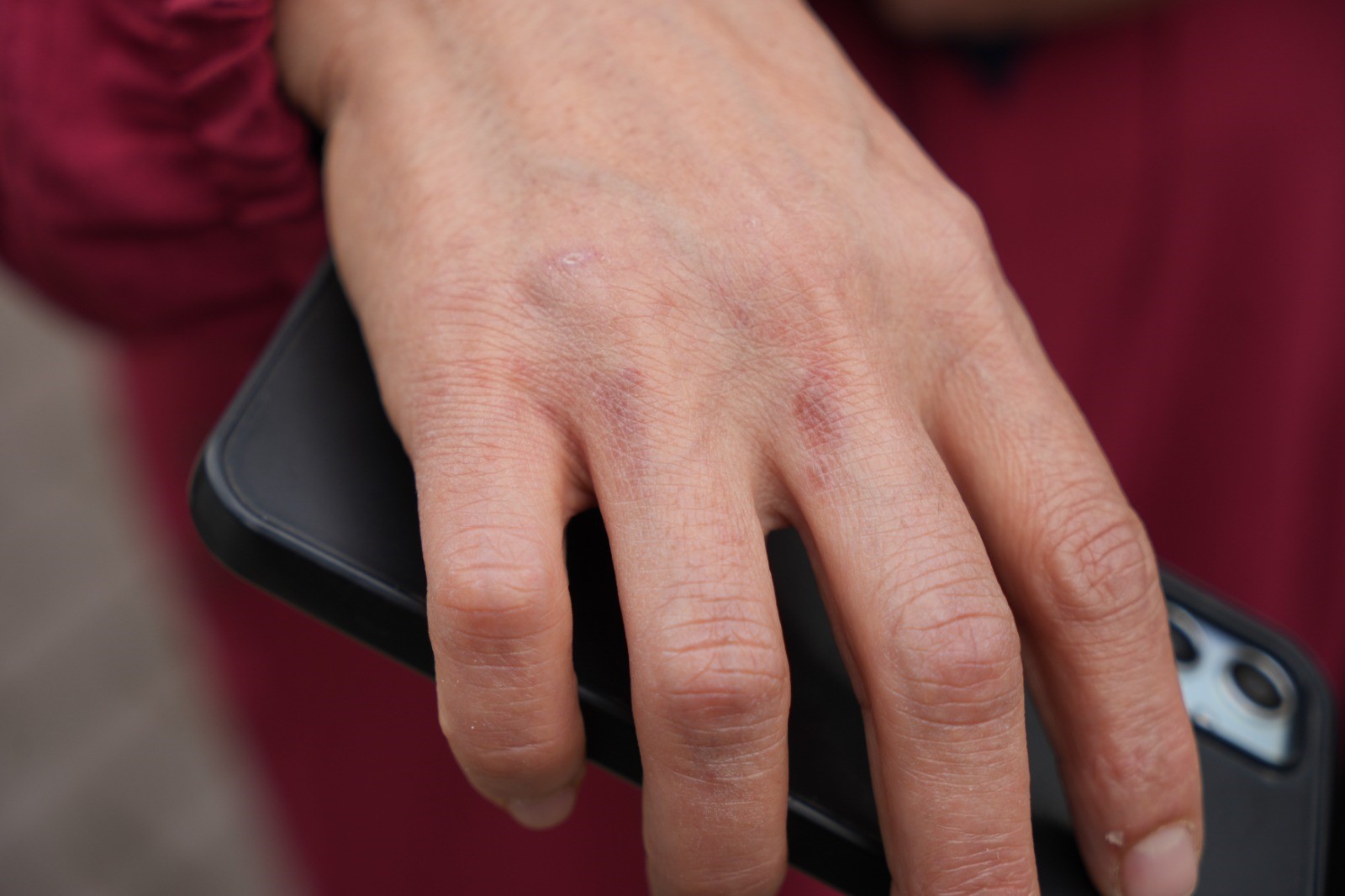 Yangından Kurtulan Ayten Aras Facia Anını Anlattı 04