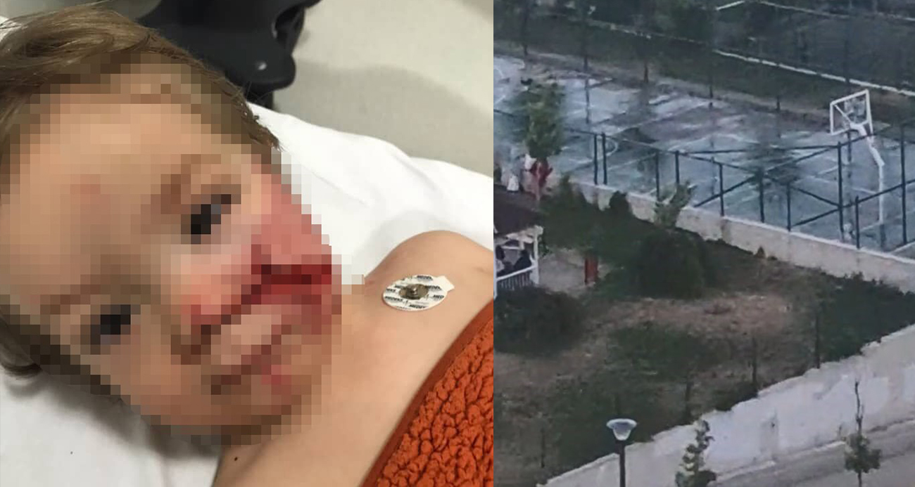 Pitbull Oyun Alanını Kana Buladı! Köpeğin Tasmasız Gezdirdiği Görüntüler Ortaya Çıktı-1