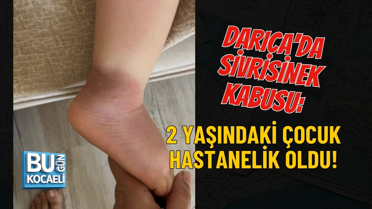 DARICA'DA SİVRİSİNEK KABUSU: 2 YAŞINDAKİ ÇOCUK HASTANELİK OLDU!