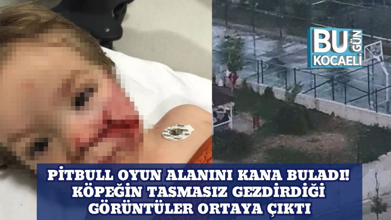 Pitbull Oyun Alanını Kana Buladı! Köpeğin Tasmasız Gezdirdiği Görüntüler Ortaya Çıktı