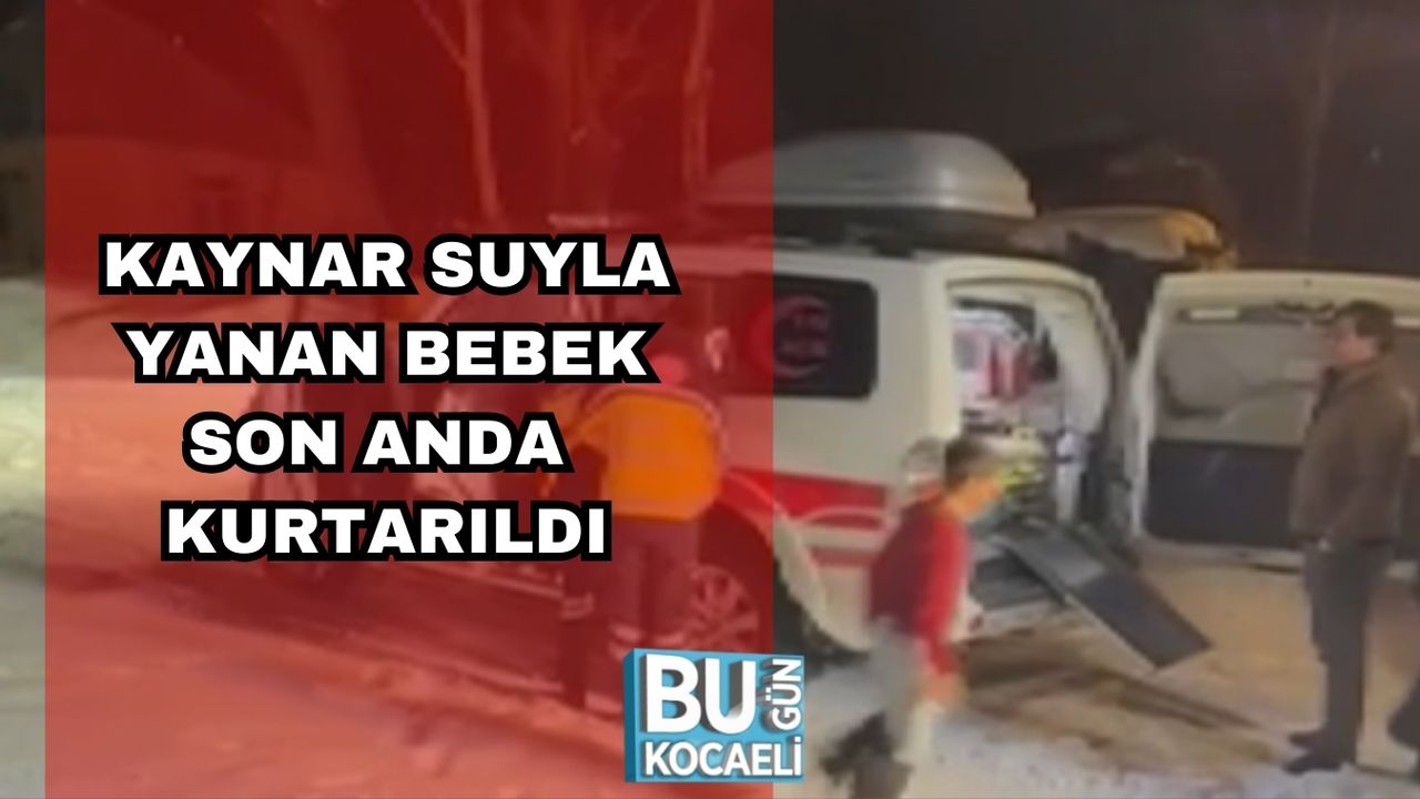 Kaynar Suyla Yanan Bebek Son Anda Kurtarıldı