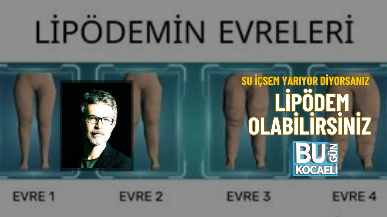 SU İÇSEM YARIYOR DİYORSANIZ LİPÖDEM OLABİLİRSİNİZ