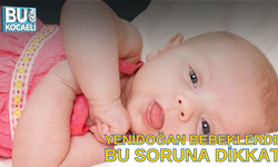 Yenidoğan bebeklerde bu soruna dikkat!