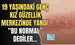 19 YAŞINDAKİ GENÇ KIZ GÜZELLİK MERKEZİNDE YANDI, "BU NORMAL" DEDİLER