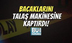 Bacaklarını Talaş Makinesine Kaptırdı!