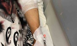 Suadiye'de Abdest Almak İçin Bahçeye Çıkan Kadına Köpekler Saldırdı