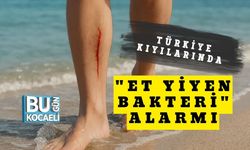 Türkiye Kıyılarında "Et Yiyen Bakteri" Alarmı
