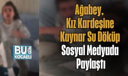 Ağabey Kız Kardeşine Kaynar Su Döküp Sosyal Medyada Paylaştı