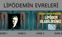 SU İÇSEM YARIYOR DİYORSANIZ LİPÖDEM OLABİLİRSİNİZ