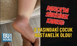 DARICA'DA SİVRİSİNEK KABUSU: 2 YAŞINDAKİ ÇOCUK HASTANELİK OLDU!