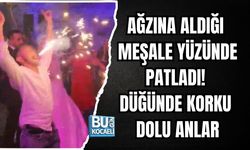 AĞZINA ALDIĞI MEŞALE YÜZÜNDE PATLADI! DÜĞÜNDE KORKU DOLU ANLAR