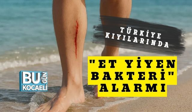 Türkiye Kıyılarında "Et Yiyen Bakteri" Alarmı
