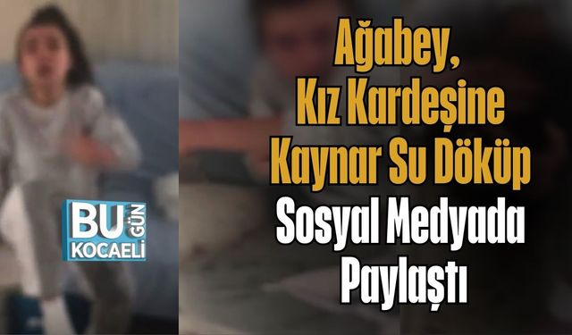 Ağabey Kız Kardeşine Kaynar Su Döküp Sosyal Medyada Paylaştı