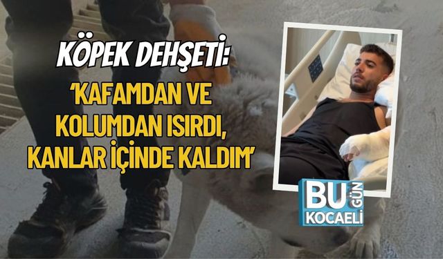 Köpek Dehşeti: ‘Kafamdan ve Kolumdan Isırdı, Kanlar İçinde Kaldım’