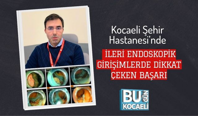 Kocaeli Şehir Hastanesi’nde İleri Endoskopik Girişimlerde Dikkat Çeken Başarı