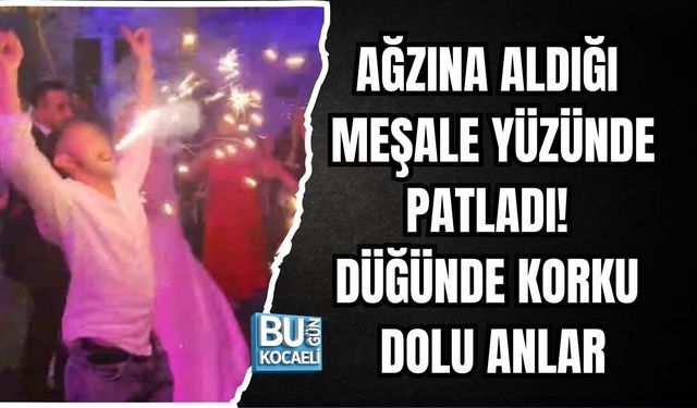 AĞZINA ALDIĞI MEŞALE YÜZÜNDE PATLADI! DÜĞÜNDE KORKU DOLU ANLAR