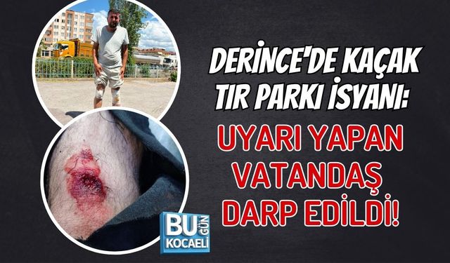 KOCAELİ DERİNCE'DE KAÇAK TIR PARKI İSYANI: UYARI YAPAN VATANDAŞ DARP EDİLDİ!