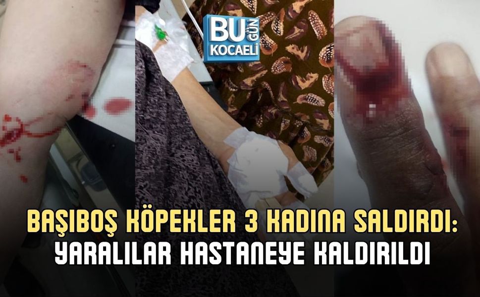 BAŞIBOŞ KÖPEKLER 3 KADINA SALDIRDI: YARALILAR HASTANEYE KALDIRILDI