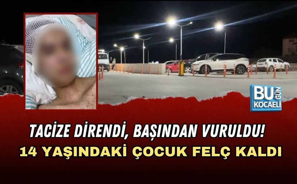 TACİZE DİRENDİ, BAŞINDAN VURULDU! 14 YAŞINDAKİ ÇOCUK FELÇ KALDI