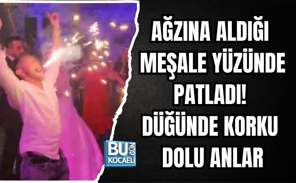 AĞZINA ALDIĞI MEŞALE YÜZÜNDE PATLADI! DÜĞÜNDE KORKU DOLU ANLAR