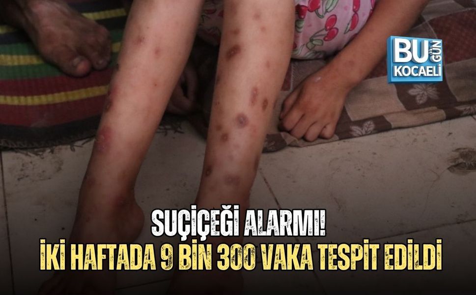 SUÇİÇEĞİ ALARMI! İKİ HAFTADA 9 BİN 300 VAKA TESPİT EDİLDİ